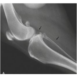 Improve Your Laser Therapy Technique: Application Technique to the ...